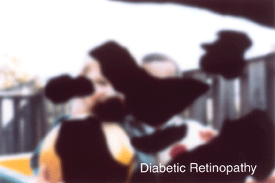 Simulated Vision with Advanced Diabetic Retinopathy
